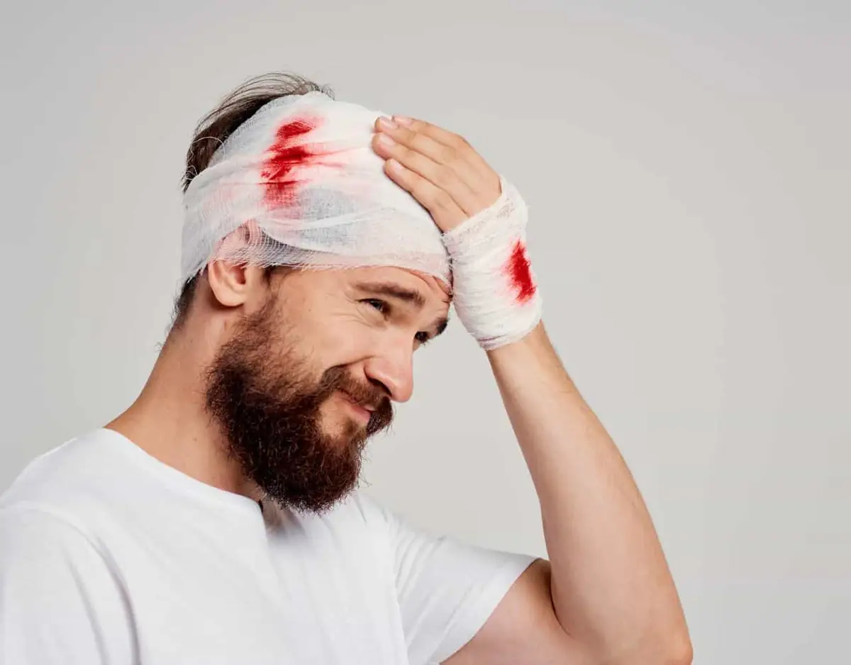 Car Accident: Seeking Compensation For A Brain Injury