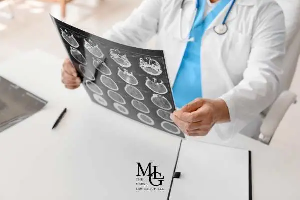 Doctor in a white coat examining a sheet of brain CT scan images