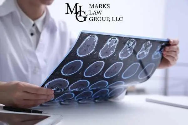 A doctor holding up a sheet of brain scan images to the light