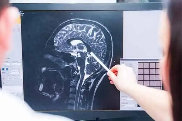 two people reviewing a brain MRI scan on a monitor, one pointing with a pen
