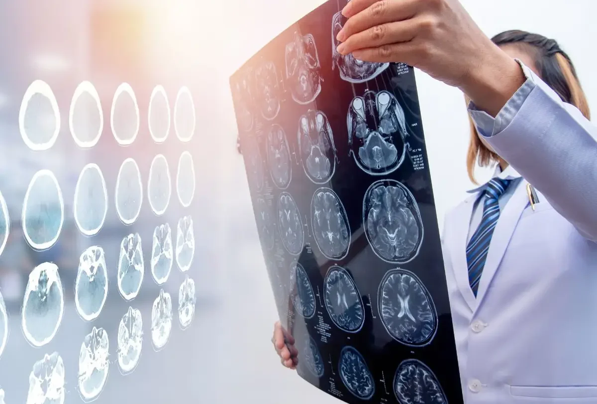 Doctor holding a sheet of brain scans up to the light