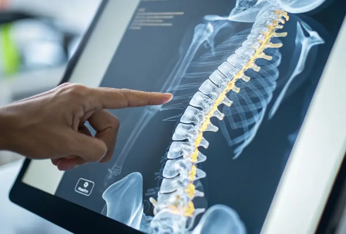 Finger pointing at a spine x-ray displayed on a computer screen