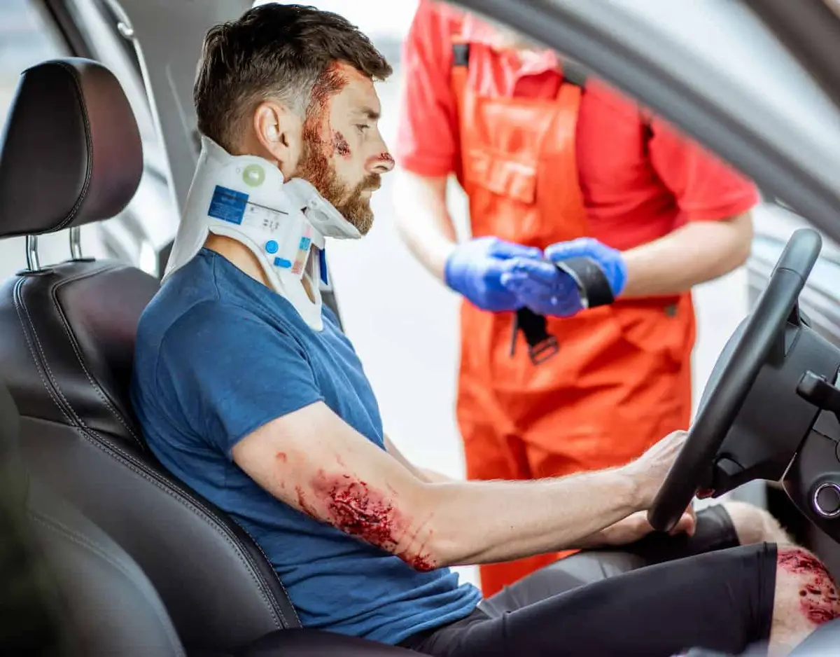 Suing for Disfigurement After a Car Accident